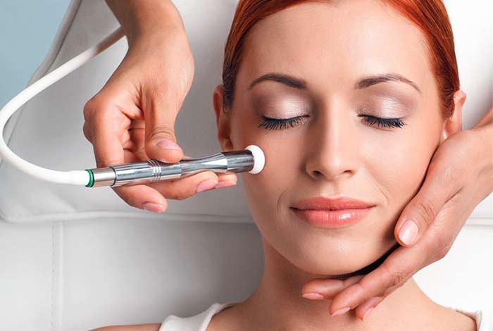 microdermabrasios