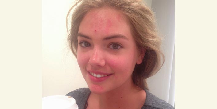 Kate Upton