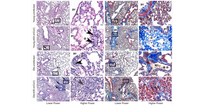 Keto-diet-protects-against-mCoV-A59-infection